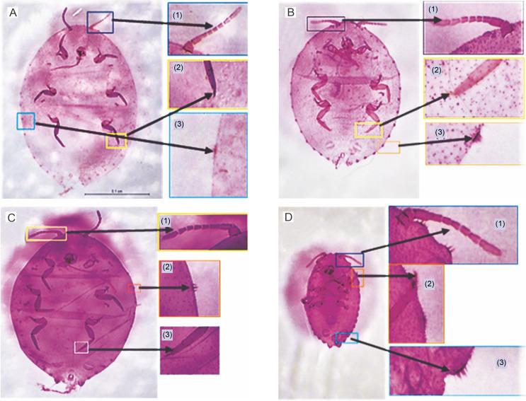 https://cdn.ncbi.nlm.nih.gov/pmc/blobs/7026/9645568/b1356d96643d/BTA-102-3-45035-g008.jpg