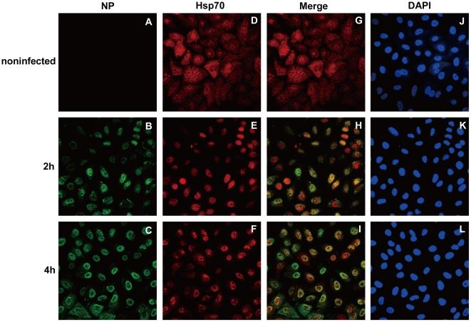 https://cdn.ncbi.nlm.nih.gov/pmc/blobs/7027/3044721/ca19a3d8637f/pone.0016546.g003.jpg