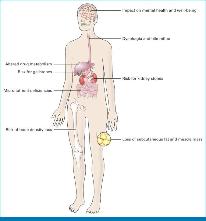 https://cdn.ncbi.nlm.nih.gov/pmc/blobs/702a/10824374/5efb5d6de45f/jco-42-421-g002.jpg