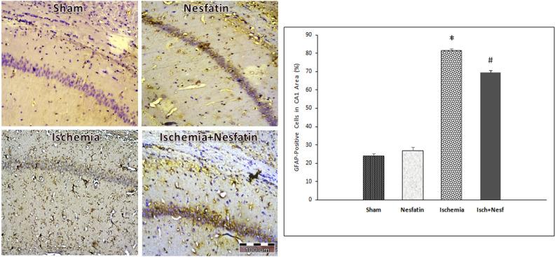 https://cdn.ncbi.nlm.nih.gov/pmc/blobs/702f/7149952/b8b81efb8648/BCN-10-451-g004.jpg