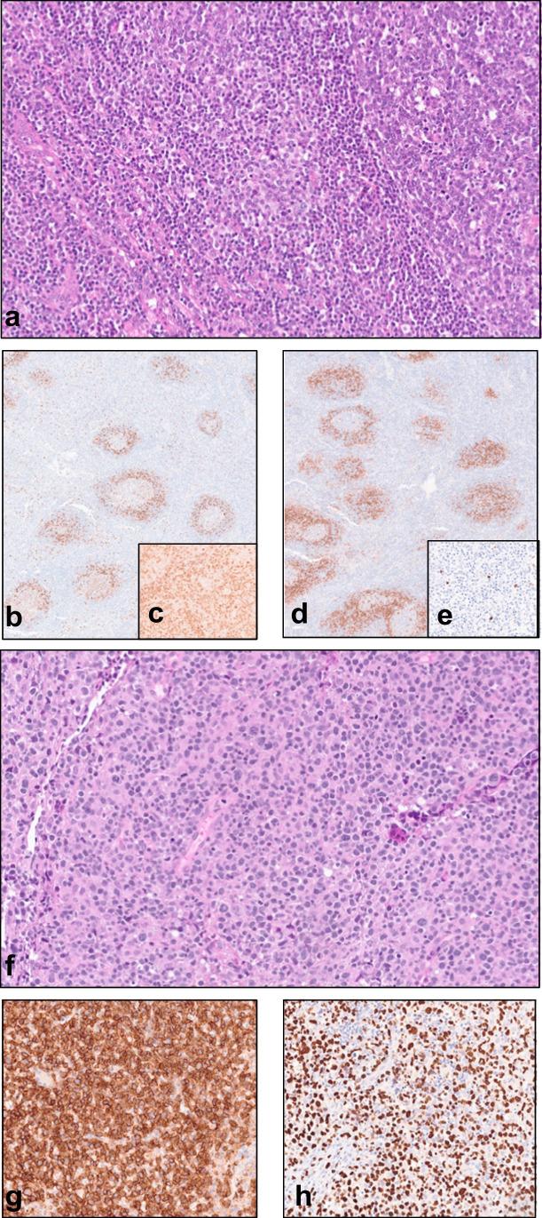 https://cdn.ncbi.nlm.nih.gov/pmc/blobs/7030/10542298/ab24e64222c2/428_2023_3616_Fig5_HTML.jpg