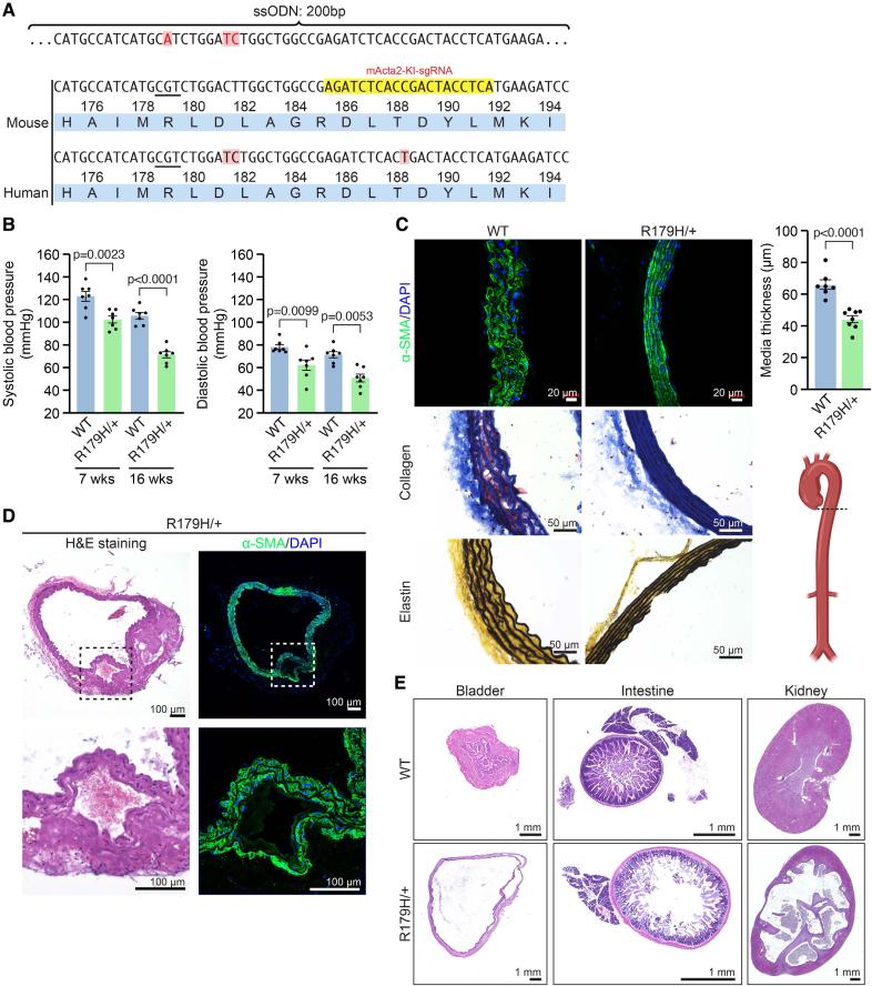 https://cdn.ncbi.nlm.nih.gov/pmc/blobs/7031/12356575/7883bb59391a/cir-152-465-g004.jpg