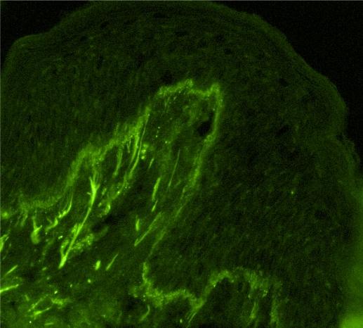 https://cdn.ncbi.nlm.nih.gov/pmc/blobs/7031/3039011/2ec1b7da8829/tcrm-7-027f3.jpg