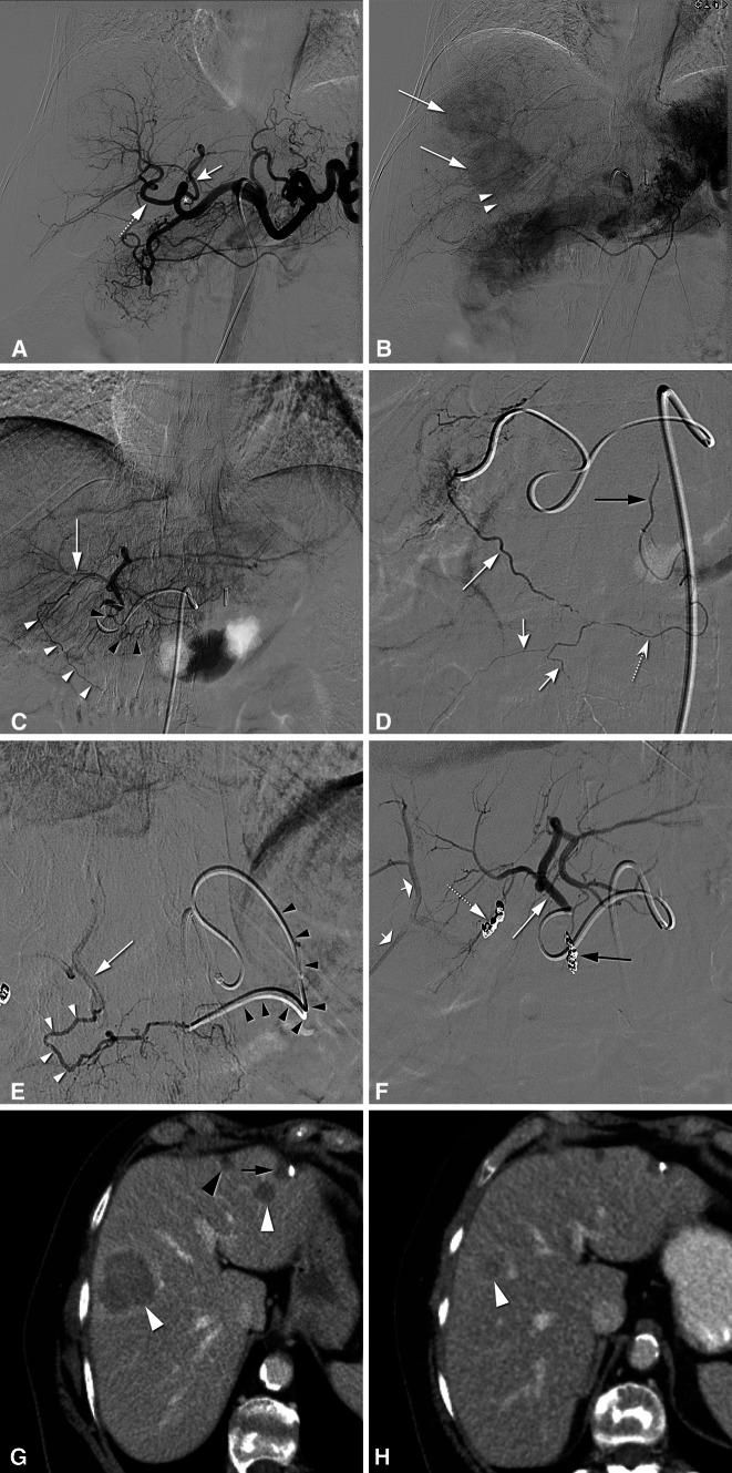 https://cdn.ncbi.nlm.nih.gov/pmc/blobs/7032/4858556/f8a00694f1ca/270_2015_1276_Fig1_HTML.jpg