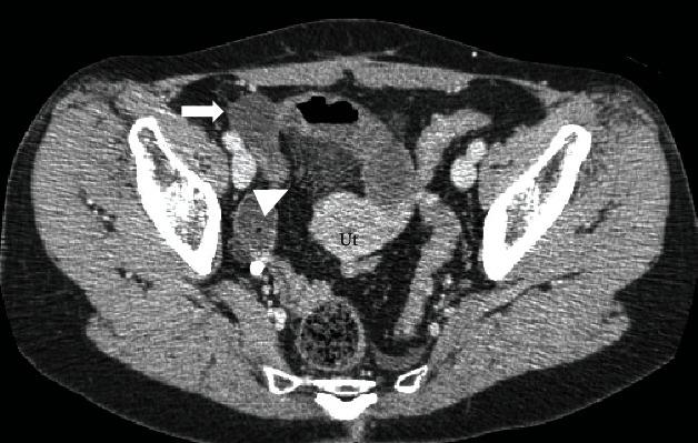 https://cdn.ncbi.nlm.nih.gov/pmc/blobs/7032/8181115/d6be959f0d9d/CRIS2021-5535162.001.jpg