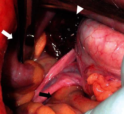 https://cdn.ncbi.nlm.nih.gov/pmc/blobs/7032/8181115/e9aa37ef00ac/CRIS2021-5535162.003.jpg