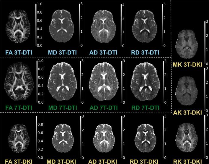 https://cdn.ncbi.nlm.nih.gov/pmc/blobs/703a/9087851/ce23fc9c2cdb/fneur-13-837385-g0002.jpg