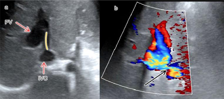 https://cdn.ncbi.nlm.nih.gov/pmc/blobs/703d/10275737/3173cc12b7d7/gr1.jpg
