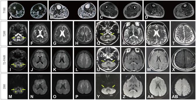 https://cdn.ncbi.nlm.nih.gov/pmc/blobs/703e/11543384/2e13d7e9b25e/jcn-20-580-g002.jpg