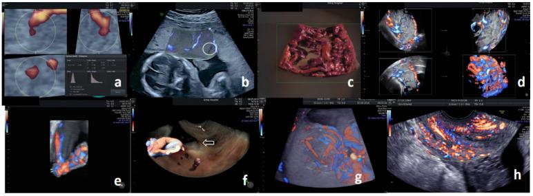 https://cdn.ncbi.nlm.nih.gov/pmc/blobs/703e/8394388/5c291c72ed25/diagnostics-11-01511-g002.jpg