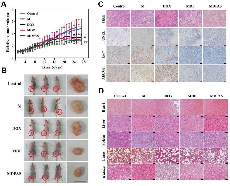 https://cdn.ncbi.nlm.nih.gov/pmc/blobs/7047/8019667/c27be5576a69/IJN-16-2569-g0008.jpg
