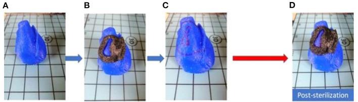 https://cdn.ncbi.nlm.nih.gov/pmc/blobs/704c/9707791/f691b261e32a/fcvm-09-1029685-g0003.jpg