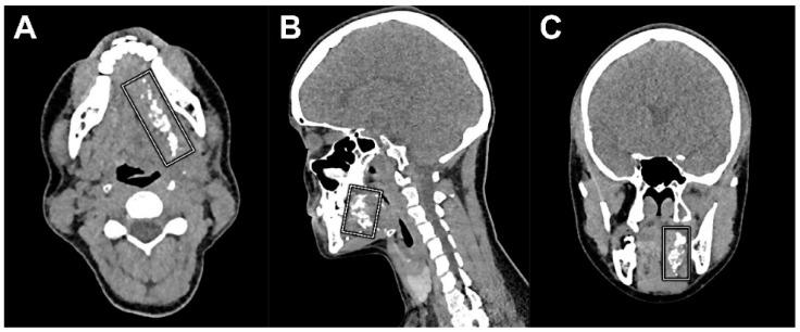 https://cdn.ncbi.nlm.nih.gov/pmc/blobs/704d/9456579/031ca06a8dae/jcm-11-05129-g006.jpg