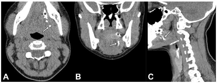 https://cdn.ncbi.nlm.nih.gov/pmc/blobs/704d/9456579/5b220e8bd3cf/jcm-11-05129-g003.jpg