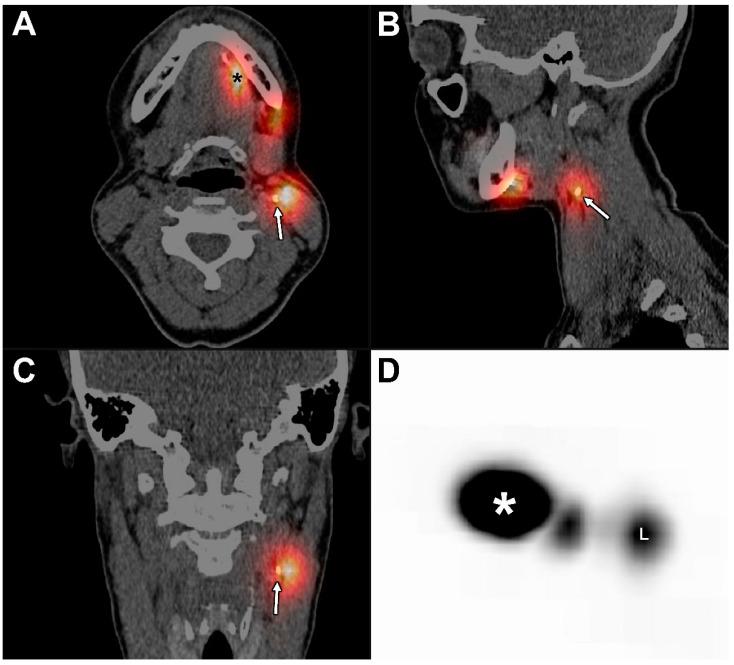https://cdn.ncbi.nlm.nih.gov/pmc/blobs/704d/9456579/b6258f4cf380/jcm-11-05129-g004.jpg