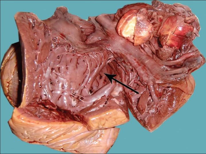 https://cdn.ncbi.nlm.nih.gov/pmc/blobs/7050/3530247/08c7beac165a/NMJ-53-102-g001.jpg
