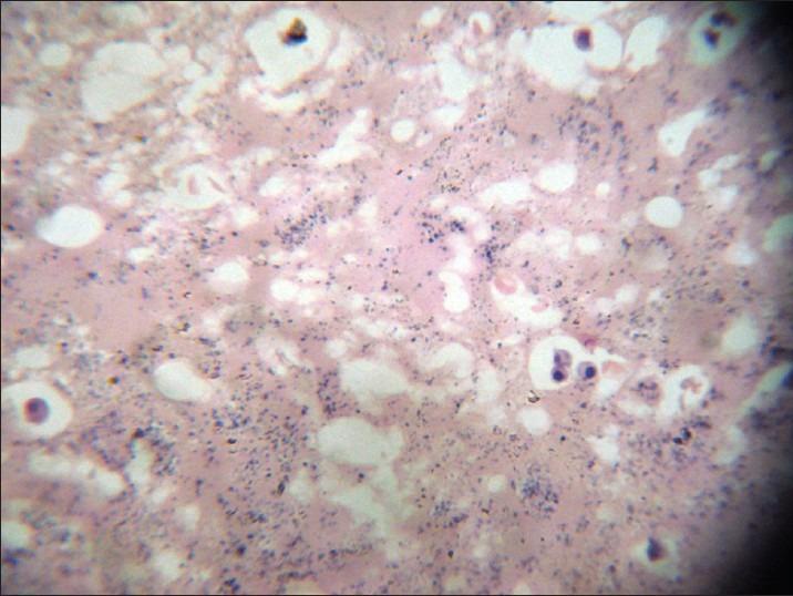 https://cdn.ncbi.nlm.nih.gov/pmc/blobs/7050/3530247/31c3e6a346ec/NMJ-53-102-g002.jpg