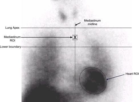 https://cdn.ncbi.nlm.nih.gov/pmc/blobs/7055/2275776/12ffe5cdd9ca/259_2007_611_Fig1_HTML.jpg