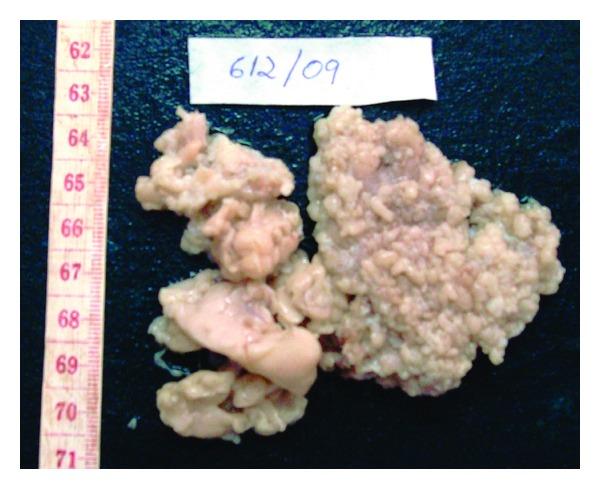https://cdn.ncbi.nlm.nih.gov/pmc/blobs/705a/3350143/e77d5dfa0d1b/CRIM.PEDIATRICS2012-134646.002.jpg