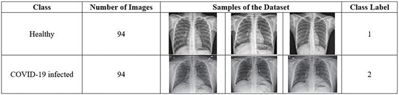 https://cdn.ncbi.nlm.nih.gov/pmc/blobs/705a/7737907/b30a0b389d63/pone.0242899.g007.jpg