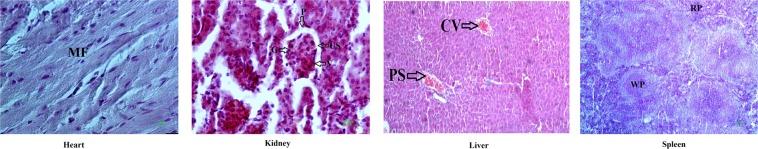 https://cdn.ncbi.nlm.nih.gov/pmc/blobs/705c/6509211/3400726b1027/41598_2019_43650_Fig11_HTML.jpg