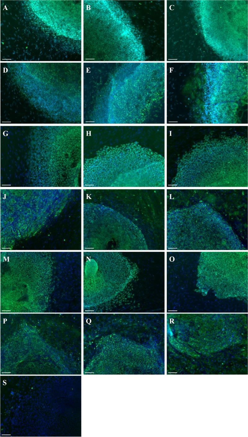 https://cdn.ncbi.nlm.nih.gov/pmc/blobs/705d/5472743/402fd06143cf/aging-09-1440-g001.jpg