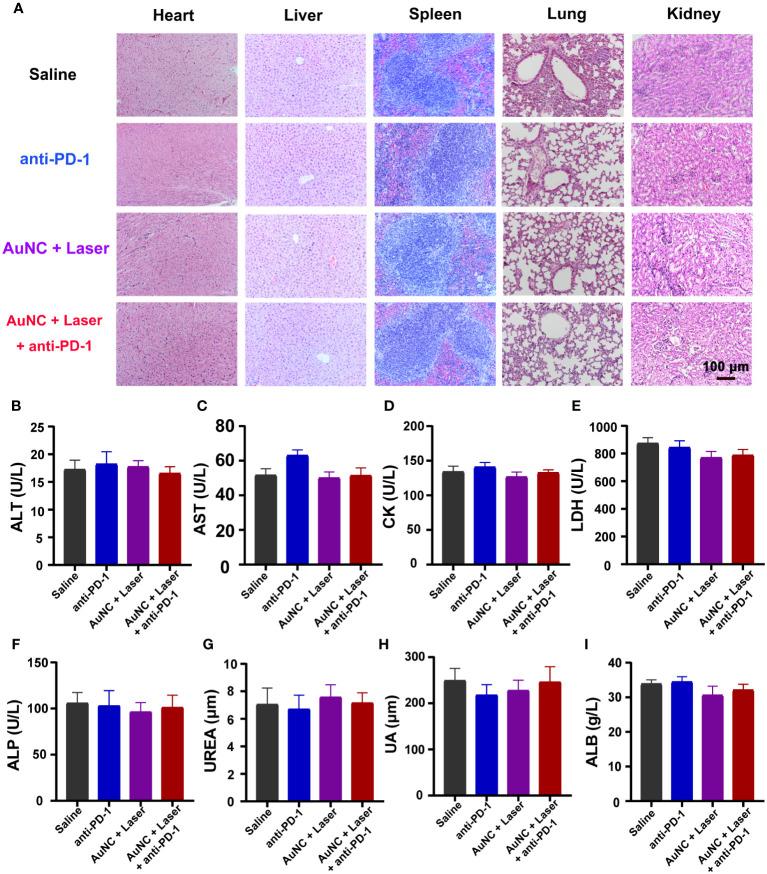 https://cdn.ncbi.nlm.nih.gov/pmc/blobs/7061/10628457/b102fc420bfb/fimmu-14-1279221-g006.jpg