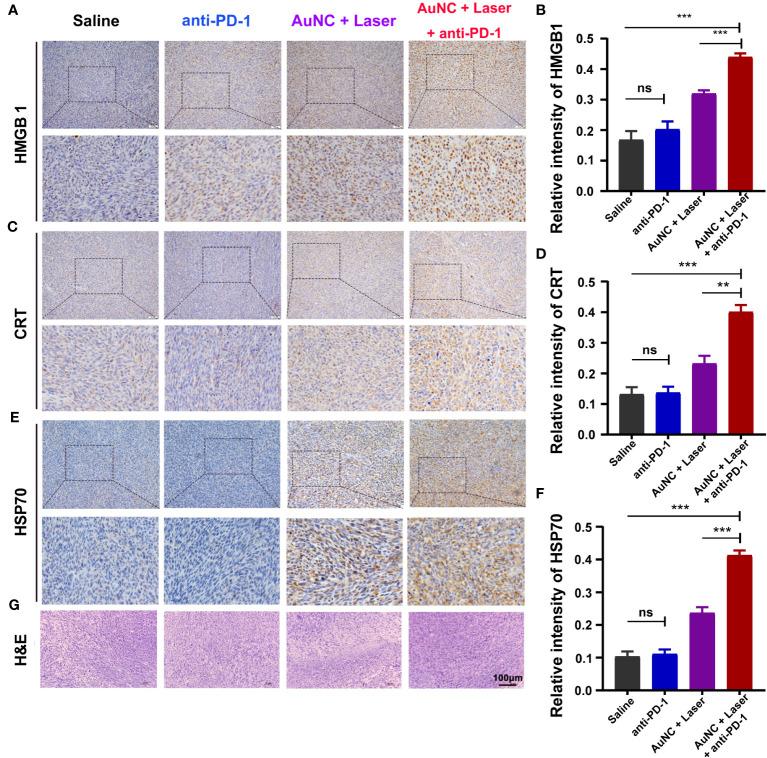 https://cdn.ncbi.nlm.nih.gov/pmc/blobs/7061/10628457/b4f8a02a46ea/fimmu-14-1279221-g005.jpg