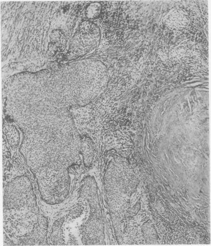 https://cdn.ncbi.nlm.nih.gov/pmc/blobs/7069/1019417/c7cbea2e150b/thorax00036-0054-a.jpg