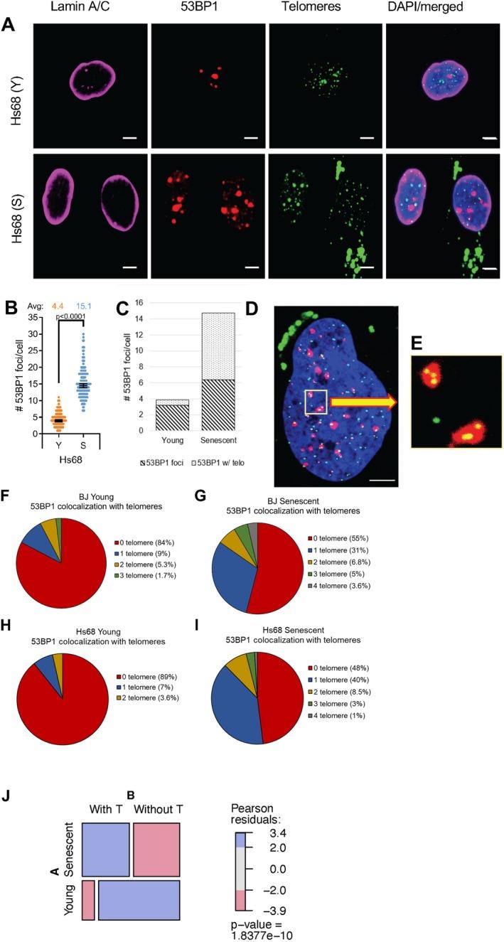 https://cdn.ncbi.nlm.nih.gov/pmc/blobs/706b/12341801/2a3e6d55180c/ACEL-24-e70105-g002.jpg