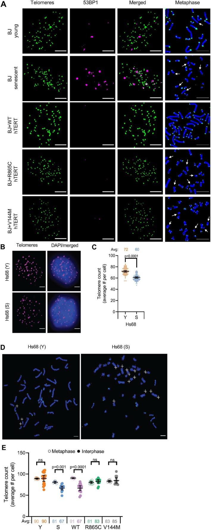 https://cdn.ncbi.nlm.nih.gov/pmc/blobs/706b/12341801/7fc12c78a3be/ACEL-24-e70105-g007.jpg