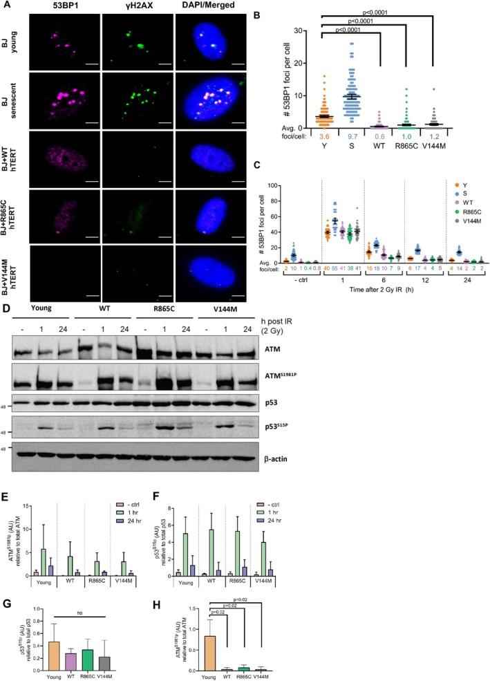 https://cdn.ncbi.nlm.nih.gov/pmc/blobs/706b/12341801/b45217982988/ACEL-24-e70105-g003.jpg