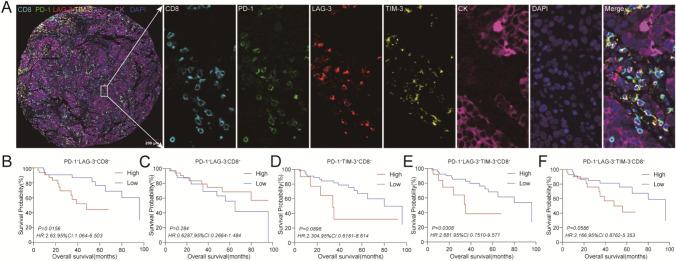 https://cdn.ncbi.nlm.nih.gov/pmc/blobs/706e/11303638/9c1b0a0fe0c3/262_2024_3791_Fig5_HTML.jpg