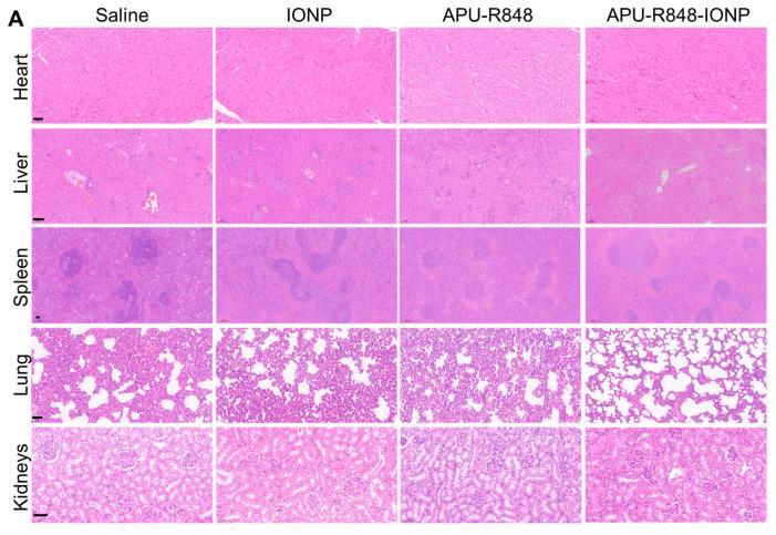 https://cdn.ncbi.nlm.nih.gov/pmc/blobs/706f/12250821/7ac42b5774fb/nanomaterials-15-01006-g006a.jpg