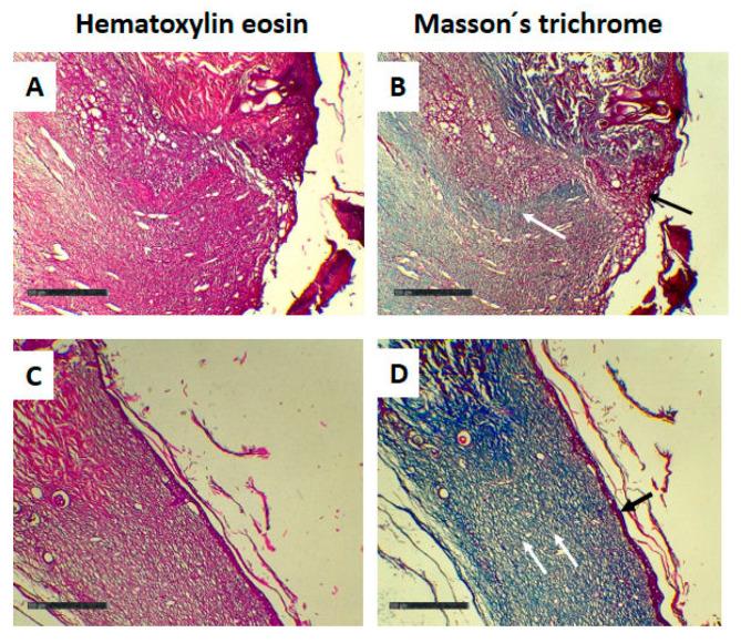 https://cdn.ncbi.nlm.nih.gov/pmc/blobs/7070/11764813/b2e2c2c7f1d6/gels-11-00036-g012.jpg