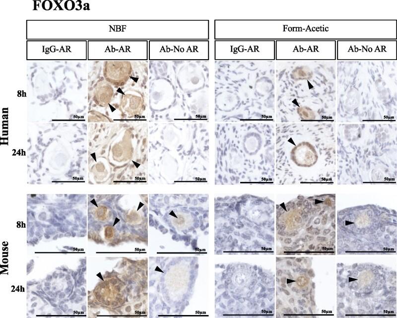 https://cdn.ncbi.nlm.nih.gov/pmc/blobs/707a/8213453/56fc6ac305a8/deab075f7.jpg