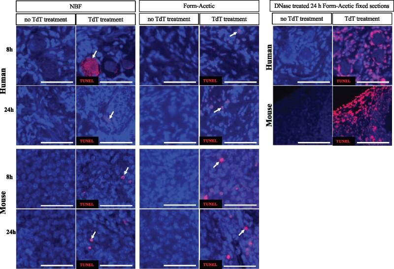 https://cdn.ncbi.nlm.nih.gov/pmc/blobs/707a/8213453/881d6a3c6fe6/deab075f13.jpg