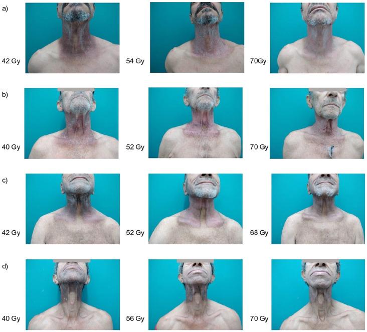 https://cdn.ncbi.nlm.nih.gov/pmc/blobs/707f/9421214/3786b4b7cace/10.1177_15347354221105491-fig1.jpg