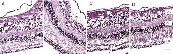 https://cdn.ncbi.nlm.nih.gov/pmc/blobs/708a/2701269/b986f6ae976b/TOOPHTJ-3-20_F3.jpg