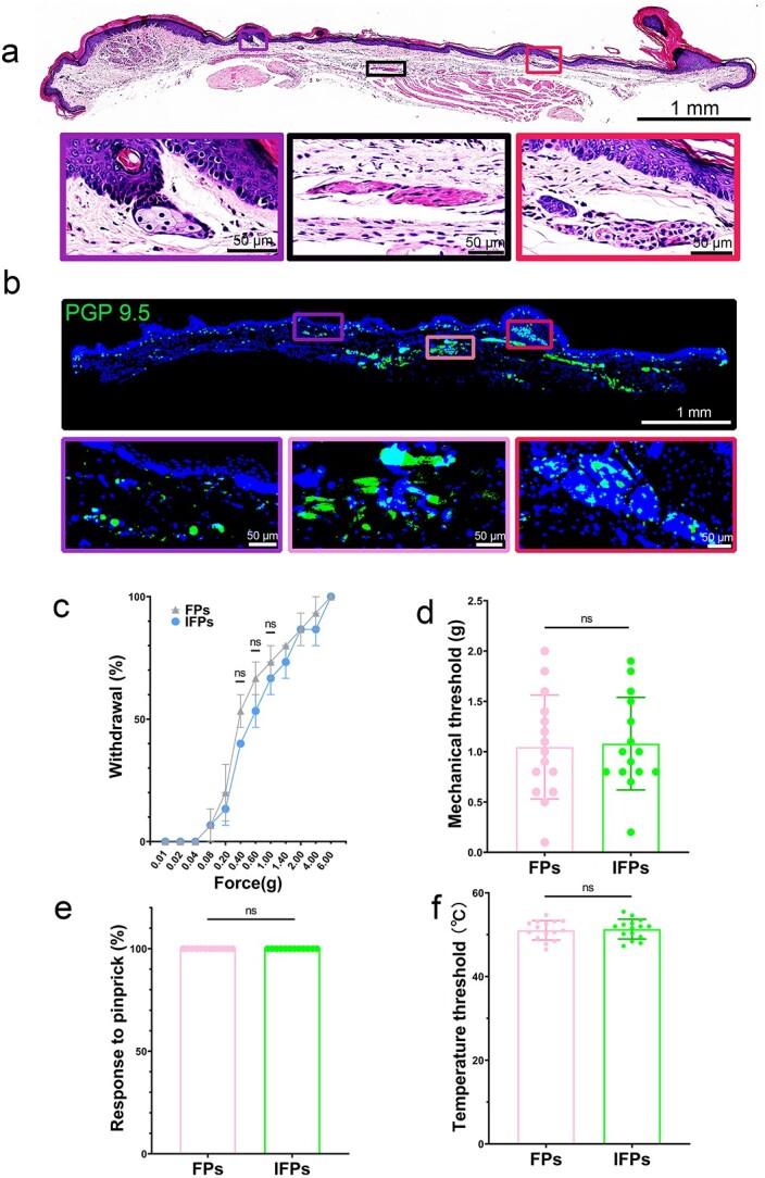 https://cdn.ncbi.nlm.nih.gov/pmc/blobs/708c/10309083/84819128d054/tkad027f2.jpg