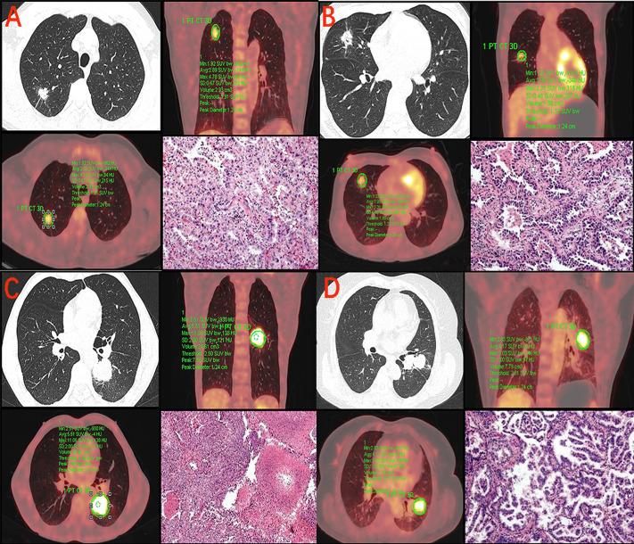 https://cdn.ncbi.nlm.nih.gov/pmc/blobs/7090/10150717/74d970708fb8/peerj-11-15242-g004.jpg