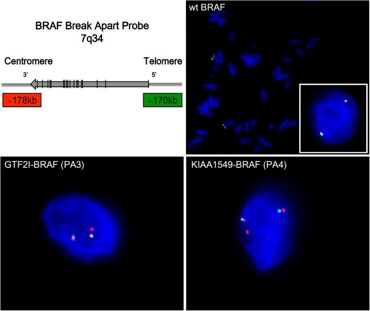 https://cdn.ncbi.nlm.nih.gov/pmc/blobs/7093/5407815/11091135274f/pone.0175638.g005.jpg