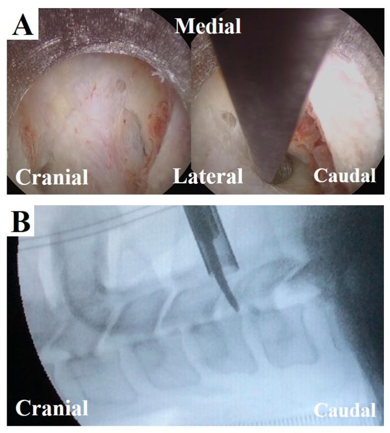 https://cdn.ncbi.nlm.nih.gov/pmc/blobs/7093/7698079/9e5be95cda1f/medicina-56-00605-g006.jpg