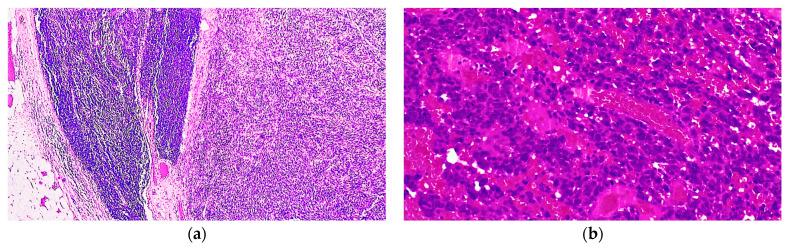 https://cdn.ncbi.nlm.nih.gov/pmc/blobs/7096/11240390/38b0631e7cc8/diagnostics-14-01323-g004.jpg
