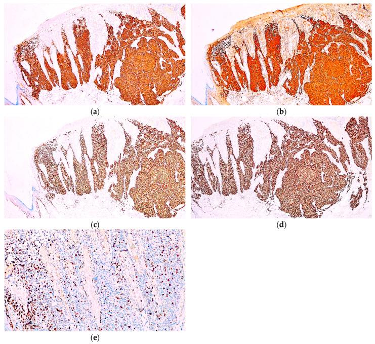 https://cdn.ncbi.nlm.nih.gov/pmc/blobs/7096/11240390/73a54d44c7b1/diagnostics-14-01323-g003.jpg