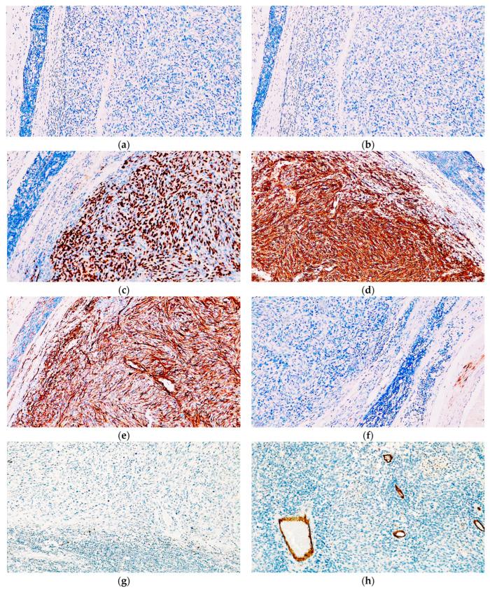 https://cdn.ncbi.nlm.nih.gov/pmc/blobs/7096/11240390/be9f46678936/diagnostics-14-01323-g005a.jpg