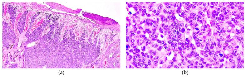 https://cdn.ncbi.nlm.nih.gov/pmc/blobs/7096/11240390/c41e2da2994a/diagnostics-14-01323-g002.jpg