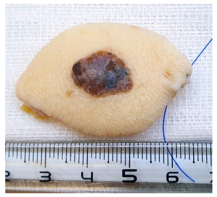 https://cdn.ncbi.nlm.nih.gov/pmc/blobs/7096/11240390/d397476f9812/diagnostics-14-01323-g001.jpg