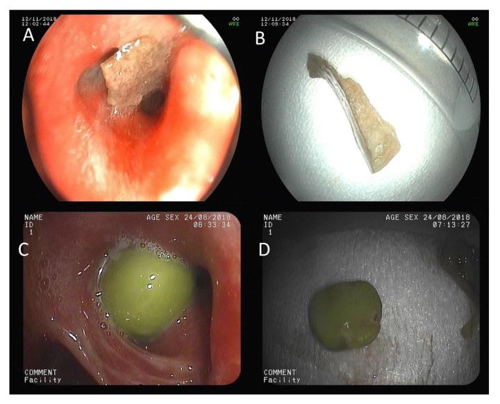 https://cdn.ncbi.nlm.nih.gov/pmc/blobs/7099/7290307/f519d6d55b78/jcm-09-01409-g001.jpg