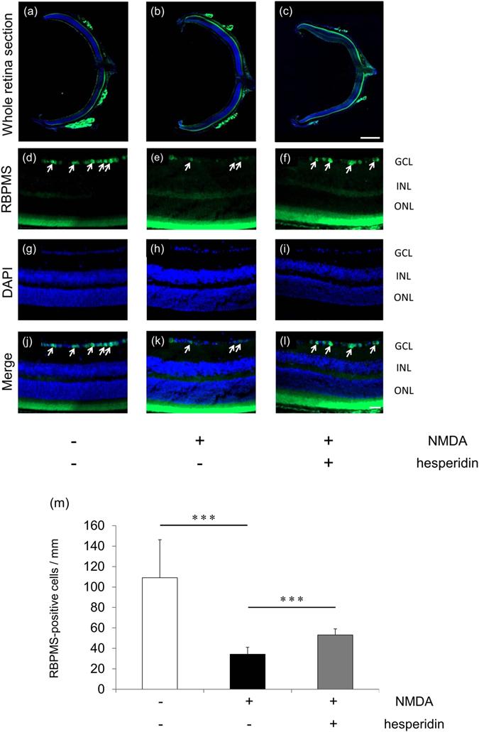 https://cdn.ncbi.nlm.nih.gov/pmc/blobs/709c/5537259/5e91a987a004/41598_2017_6969_Fig3_HTML.jpg